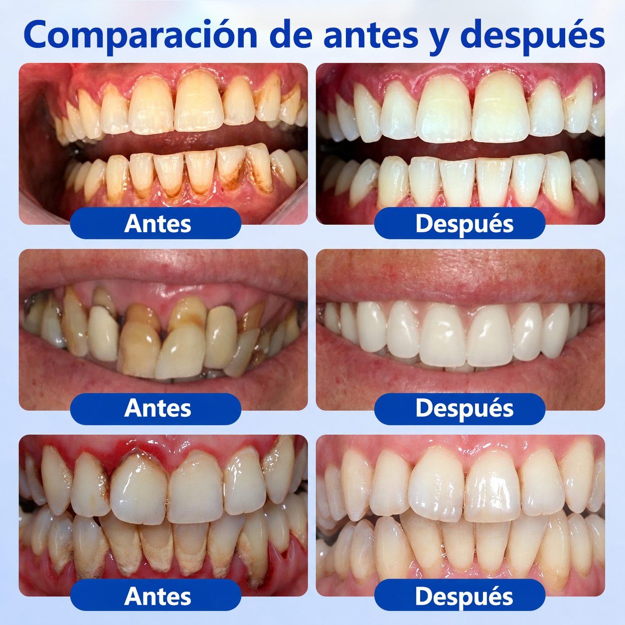 🍁💖 𝑮𝒍𝒊𝒎𝒎𝒆𝒓𝒍𝒚® 𝑮𝒖𝒎𝑹𝒆𝒗𝒊𝒗𝒆 𝑮𝒆𝒍 𝑹𝒆𝒑𝒂𝒓𝒂𝒅𝒐𝒓 𝑷𝒆𝒓𝒊𝒐𝒅𝒐𝒏𝒕𝒂𝒍