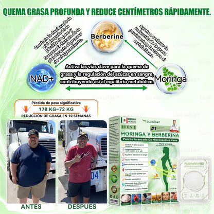 𝑻𝒊𝒆𝒏𝒅𝒂 𝑶𝒇𝒊𝒄𝒊𝒂𝒍 |  𝑳𝒖𝒙𝒂𝒓𝒊𝒔𝒆® 10 𝑬𝑵 1 𝑴𝒐𝒓𝒊𝒏𝒈𝒂 𝒀 𝑩𝒆𝒓𝒃𝒆𝒓𝒊𝒏𝒂 𝑷𝒂𝒓𝒄𝒉𝒆 𝑨𝒗𝒂𝒏𝒛𝒂𝒅𝒐 𝑫𝒆 𝑴𝒊𝒄𝒓𝒐𝒏𝒆𝒆𝒅𝒍𝒆𝒔 𝑵𝒂𝒏𝒐（𝑼𝒏𝒂 𝒗𝒆𝒛 𝒂𝒍 𝒅í𝒂, 𝒄𝒂𝒎𝒃𝒊𝒐𝒔 𝒗𝒊𝒔𝒊𝒃𝒍𝒆𝒔 𝒆𝒏 7 𝒅í𝒂𝒔（UPSELL）