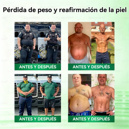 𝑻𝒊𝒆𝒏𝒅𝒂 𝑶𝒇𝒊𝒄𝒊𝒂𝒍 |  𝑳𝒖𝒙𝒂𝒓𝒊𝒔𝒆® 10 𝑬𝑵 1 𝑴𝒐𝒓𝒊𝒏𝒈𝒂 𝒀 𝑩𝒆𝒓𝒃𝒆𝒓𝒊𝒏𝒂 𝑷𝒂𝒓𝒄𝒉𝒆 𝑨𝒗𝒂𝒏𝒛𝒂𝒅𝒐 𝑫𝒆 𝑴𝒊𝒄𝒓𝒐𝒏𝒆𝒆𝒅𝒍𝒆𝒔 𝑵𝒂𝒏𝒐（𝑼𝒏𝒂 𝒗𝒆𝒛 𝒂𝒍 𝒅í𝒂, 𝒄𝒂𝒎𝒃𝒊𝒐𝒔 𝒗𝒊𝒔𝒊𝒃𝒍𝒆𝒔 𝒆𝒏 7 𝒅í𝒂𝒔（UPSELL）