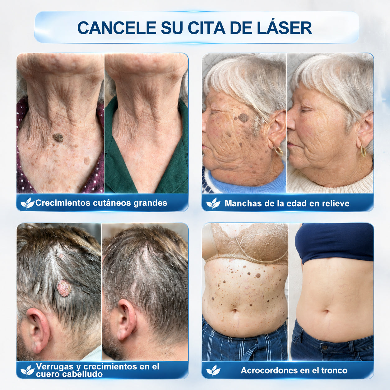 𝐏i𝐜𝐝o®🍁💖 𝟕 𝐃í𝐚𝐬 𝐋á𝐩𝐢𝐳 𝐏𝐚𝐫𝐚 𝐄𝐥𝐢𝐦𝐢𝐧𝐚𝐫 𝐋𝐮𝐧𝐚𝐫𝐞𝐬 𝐘 𝐌𝐚𝐧𝐜𝐡𝐚𝐬(Roll-on Cero Dolor, Cero Cicatrices)