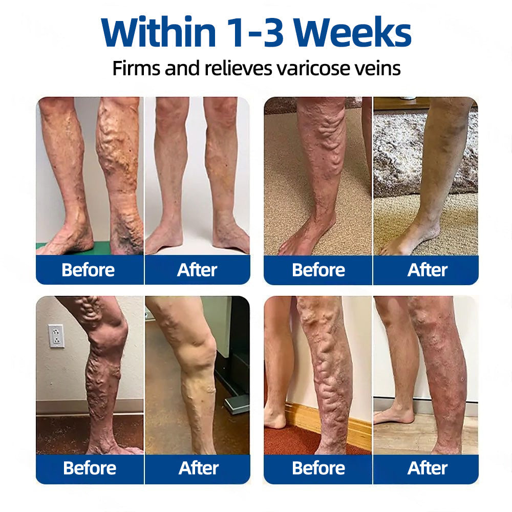 ✅𝐅𝐥𝐨𝐫𝐢𝐬𝐦𝐚®🌴💖𝐕𝐞𝐢𝐧𝐓𝐚𝐫𝐠𝐞𝐭 𝐌𝐢𝐜𝐫𝐨𝐧𝐞𝐞𝐝𝐥𝐞 𝐏𝐚𝐭𝐜𝐡⚡Instant Relief, Long-Term Results
