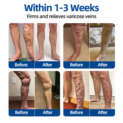 ✅𝐅𝐥𝐨𝐫𝐢𝐬𝐦𝐚®🌴💖𝐕𝐞𝐢𝐧𝐓𝐚𝐫𝐠𝐞𝐭 𝐌𝐢𝐜𝐫𝐨𝐧𝐞𝐞𝐝𝐥𝐞 𝐏𝐚𝐭𝐜𝐡⚡Instant Relief, Long-Term Results