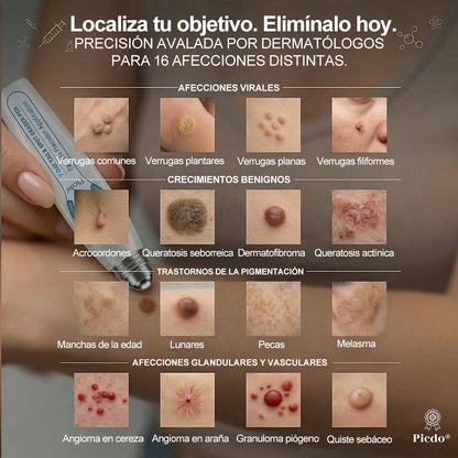 𝐏i𝐜𝐝o®🍁💖 𝟕 𝐃í𝐚𝐬 𝐋á𝐩𝐢𝐳 𝐏𝐚𝐫𝐚 𝐄𝐥𝐢𝐦𝐢𝐧𝐚𝐫 𝐋𝐮𝐧𝐚𝐫𝐞𝐬 𝐘 𝐌𝐚𝐧𝐜𝐡𝐚𝐬(Roll-on Cero Dolor, Cero Cicatrices)