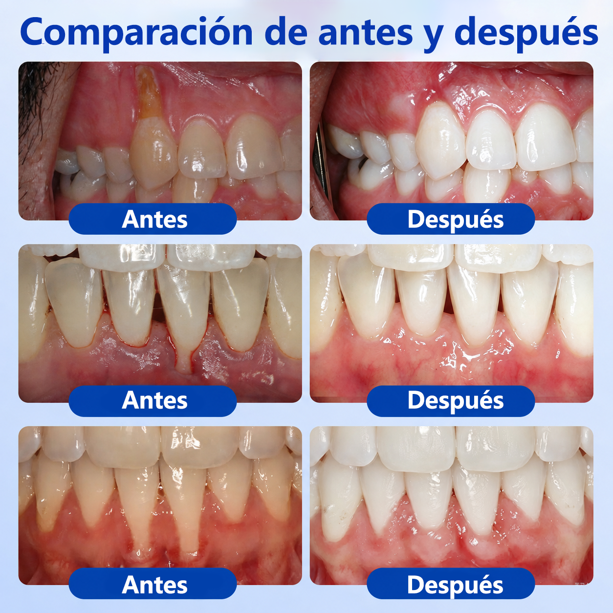 🍁💖 𝑮𝒍𝒊𝒎𝒎𝒆𝒓𝒍𝒚® 𝑮𝒖𝒎𝑹𝒆𝒗𝒊𝒗𝒆 𝑮𝒆𝒍 𝑹𝒆𝒑𝒂𝒓𝒂𝒅𝒐𝒓 𝑷𝒆𝒓𝒊𝒐𝒅𝒐𝒏𝒕𝒂𝒍