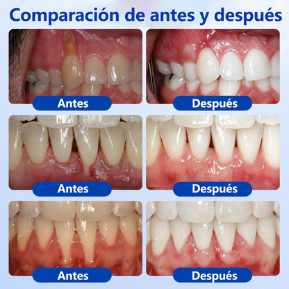 🍁💖 𝑮𝒍𝒊𝒎𝒎𝒆𝒓𝒍𝒚® 𝑮𝒖𝒎𝑹𝒆𝒗𝒊𝒗𝒆 𝑮𝒆𝒍 𝑹𝒆𝒑𝒂𝒓𝒂𝒅𝒐𝒓 𝑷𝒆𝒓𝒊𝒐𝒅𝒐𝒏𝒕𝒂𝒍